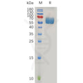 Human TGFBR2 Protein, hFc Tag – Figure 1 of 1