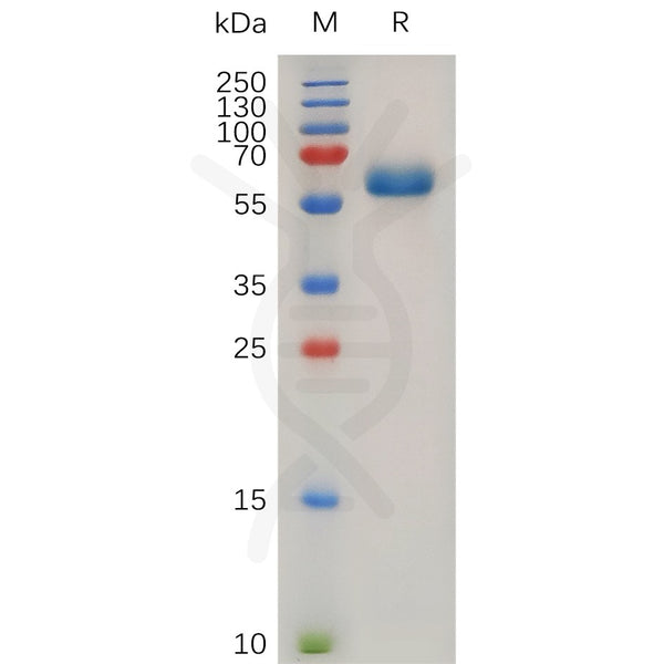 Human TNFRSF1A Protein, hFc Tag – Figure 1 of 1