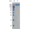 Human FLT1 Protein, hFc Tag – Figure 1 of 1