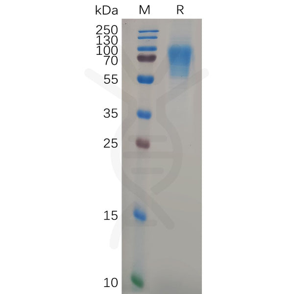 Human CD6 Protein, His Tag – Figure 1 of 1