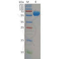 Human B7-H5 Protein, hFc Tag – Figure 1 of 1