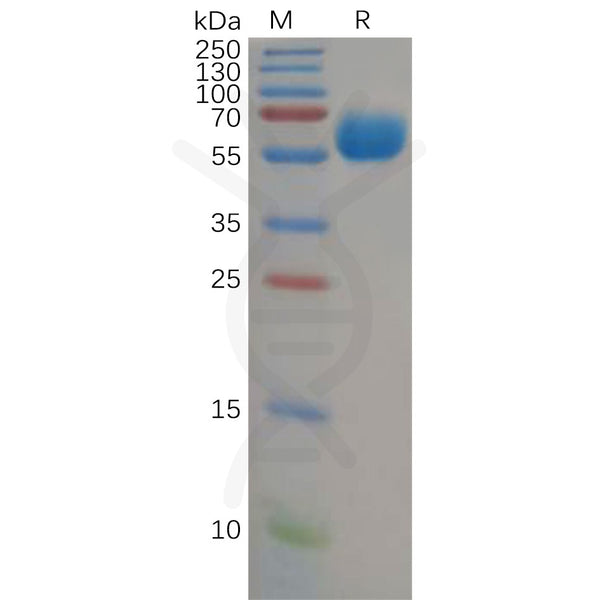 Human B7-H5 Protein, hFc Tag – Figure 1 of 1