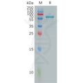 Human FGL1 Protein, hFc Tag – Figure 1 of 1