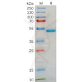 Human IL18 Protein, hFc Tag – Figure 1 of 1