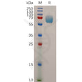 Human IFNGR1 Protein, hFc Tag – Figure 1 of 1