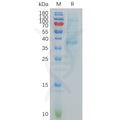 Human CXCL13 Protein, hFc Tag – Figure 1 of 1