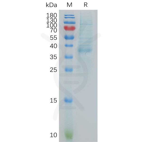 Human CXCL13 Protein, hFc Tag – Figure 1 of 1