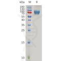 Human IL2RG Protein, hFc Tag – Figure 1 of 1
