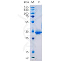 Human TM4SF1 (31-49) Protein, hFc Tag – Figure 1 of 1