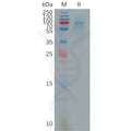 Human CXCL16 Protein, hFc Tag – Figure 1 of 1