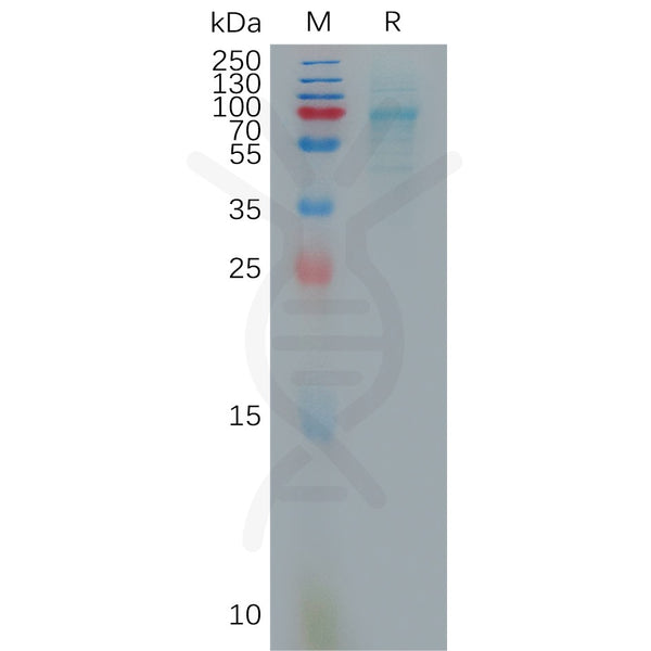 Human CXCL16 Protein, hFc Tag – Figure 1 of 1