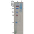 Human GPC1 Protein, His Tag – Figure 1 of 1