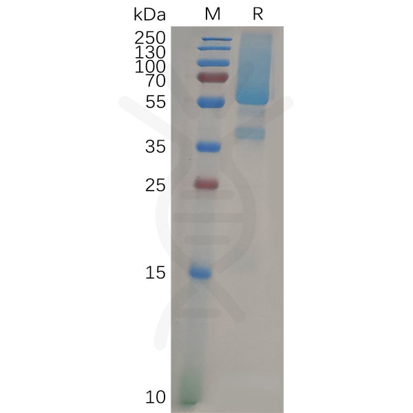Human GPC1 Protein, His Tag – Figure 1 of 1