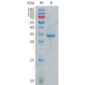 Human CT83 Protein, hFc Tag – Figure 1 of 1