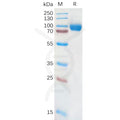 Human IL18RA Protein, hFc Tag – Figure 1 of 1