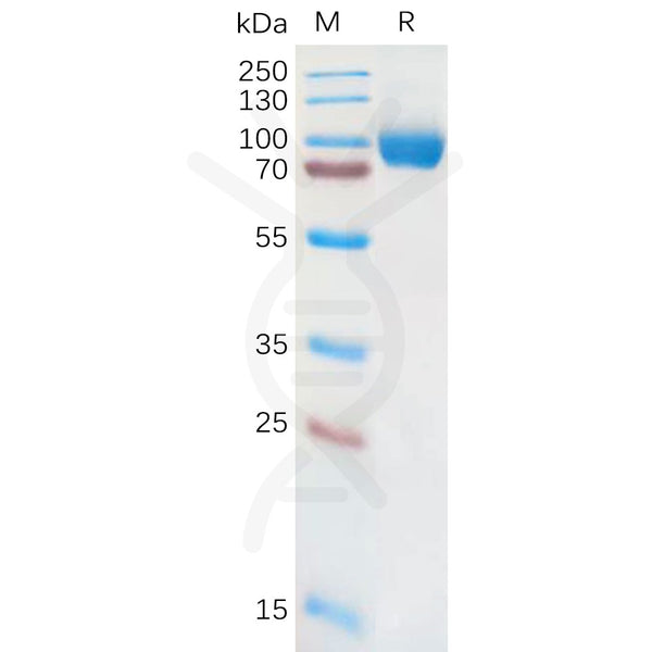 Human IL18RA Protein, hFc Tag – Figure 1 of 1