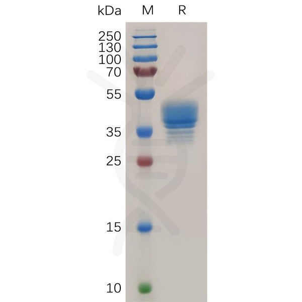 Human CCR3 Protein, hFc Tag – Figure 1 of 1