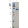 Human IL20 Protein, hFc Tag – Figure 1 of 1