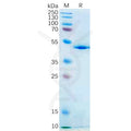 Human IL21 Protein, hFc Tag – Figure 1 of 1