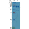 Human CD79B Protein, hFc Tag – Figure 1 of 1