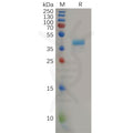 Human CCR8 Protein, hFc Tag – Figure 1 of 1
