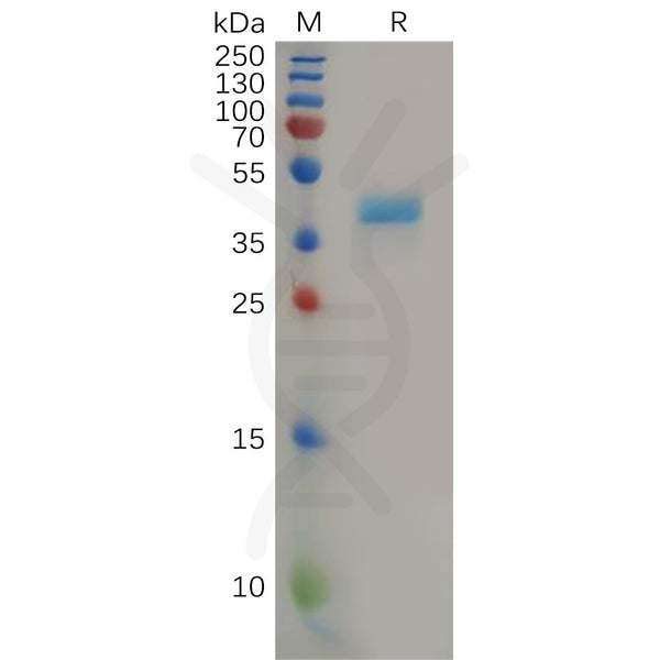 Human CCR8 Protein, hFc Tag – Figure 1 of 1