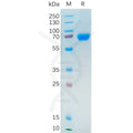 Human NRG1 Protein, hFc Tag – Figure 1 of 1