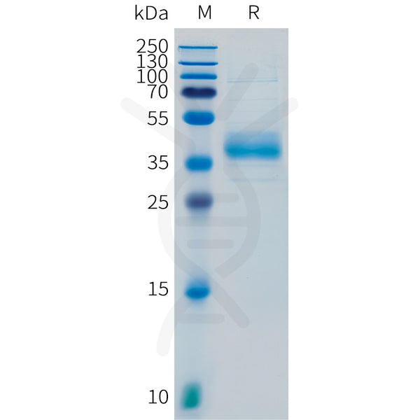 Human SCGB2A2 Protein, hFc Tag – Figure 1 of 1