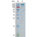 Human ENPP3 Protein, hFc Tag – Figure 1 of 1