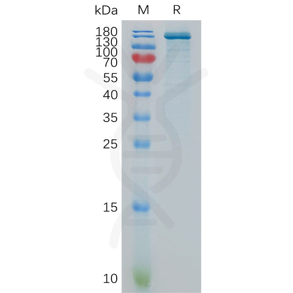 Human ENPP3 Protein, hFc Tag – Figure 1 of 1