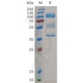 Human ZP3 Protein, hFc Tag – Figure 1 of 1