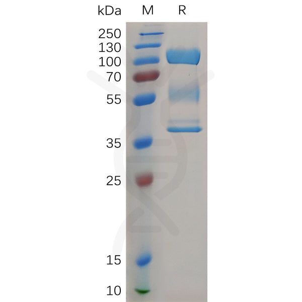 Human ZP3 Protein, hFc Tag – Figure 1 of 1