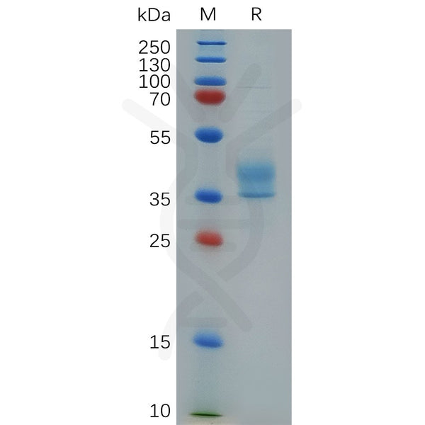 Human CCR8 Protein, mFc Tag – Figure 1 of 1