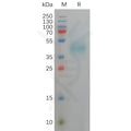 Human DLK1 Protein, His Tag – Figure 1 of 1