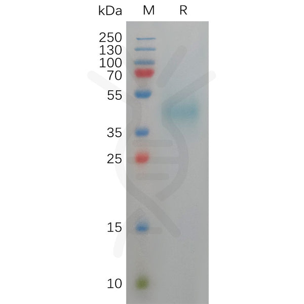 Human DLK1 Protein, His Tag – Figure 1 of 1