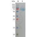 Human FGFR3 Protein, His Tag – Figure 1 of 1
