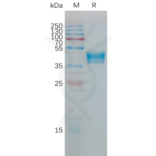Human HCRTR1 Protein, hFc Tag – Figure 1 of 1