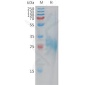Human CLEC1B Protein, His Tag – Figure 1 of 1
