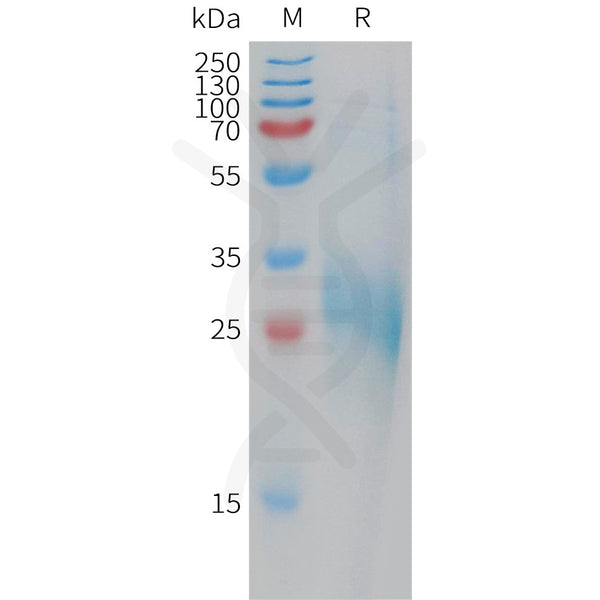 Human CLEC1B Protein, His Tag – Figure 1 of 1