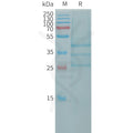 Human BMP2 Protein, hFc Tag – Figure 1 of 1