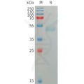 Human SIRPG Protein, His Tag – Figure 1 of 1