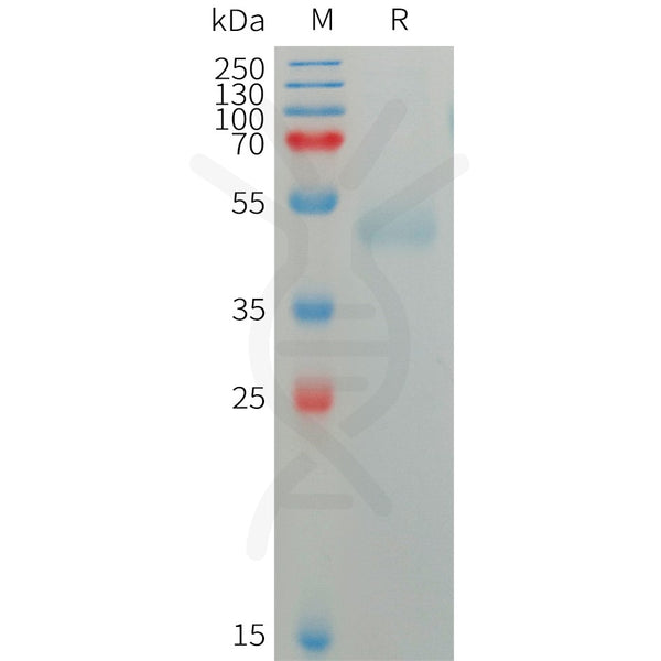 Human SIRPG Protein, His Tag – Figure 1 of 1