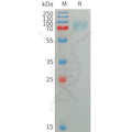 Human SIGLEC5 Protein, His Tag – Figure 1 of 1