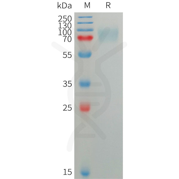 Human SIGLEC5 Protein, His Tag – Figure 1 of 1