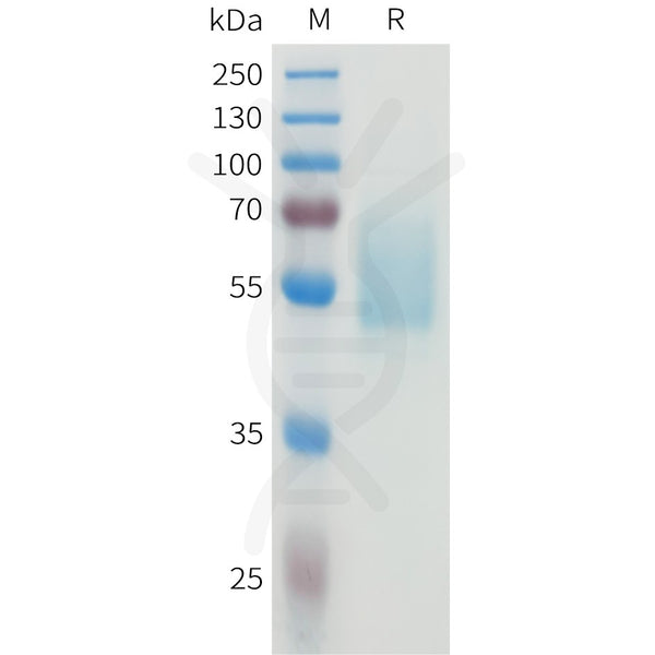 Human CEACAM5(145-239) Protein, hFc Tag – Figure 1 of 1