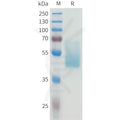 Human CEACAM5(411-500) Protein, hFc Tag – Figure 1 of 1
