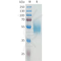 Human CEACAM5(496-592) Protein, hFc Tag – Figure 1 of 1