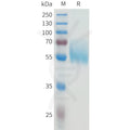 Human B7-H4(147-259) Protein, hFc Tag – Figure 1 of 1