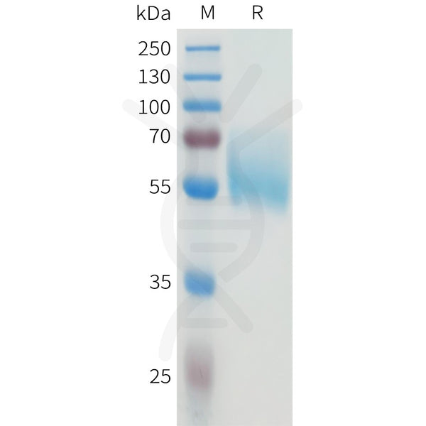 Human B7-H4(147-259) Protein, hFc Tag – Figure 1 of 1