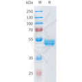 Human ROR2(34-168) Protein, hFc Tag – Figure 1 of 1